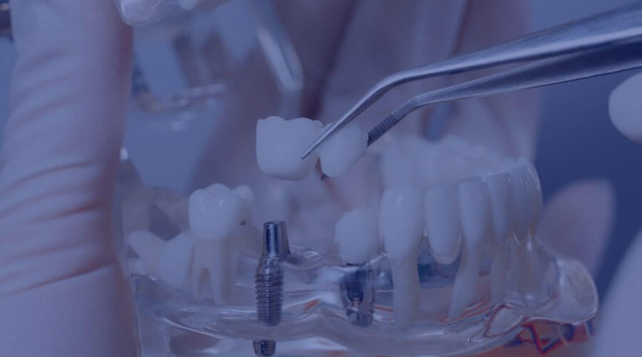 home-course-img1-dental-ilamed-2024